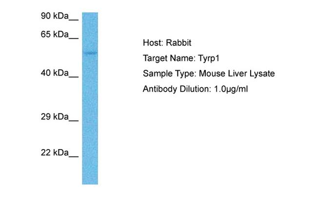 TYRP1 Antibody in Western Blot (WB)