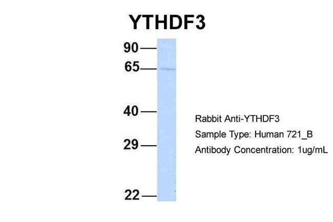 YTHDF3 Antibody in Western Blot (WB)