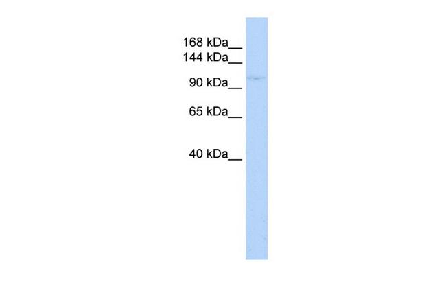 ZBTB11 Antibody in Western Blot (WB)