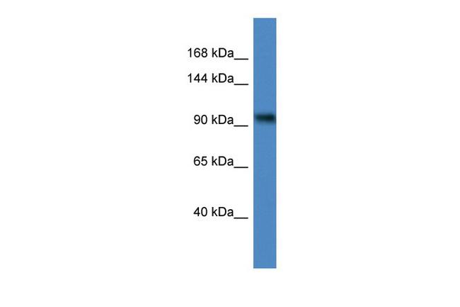 ZBTB4 Antibody in Western Blot (WB)