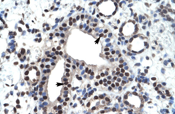 ZBTB45 Antibody in Immunohistochemistry (Paraffin) (IHC (P))