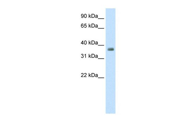 ZFP36 Antibody in Western Blot (WB)