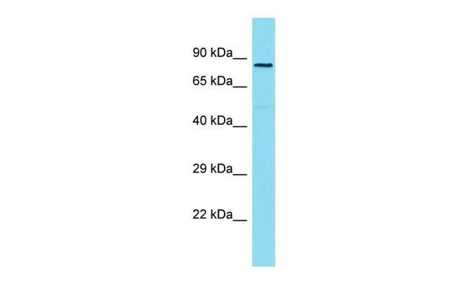 ZYG11A Antibody in Western Blot (WB)