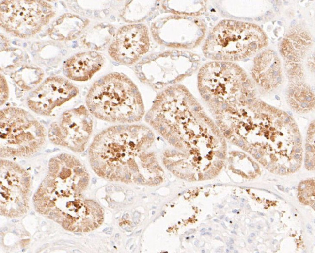 FBP1 Antibody in Immunohistochemistry (Paraffin) (IHC (P))