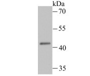 LOX-1 Antibody in Immunocytochemistry (ICC/IF)