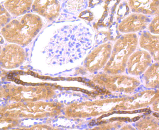 LOX-1 Antibody in Immunocytochemistry (ICC/IF)