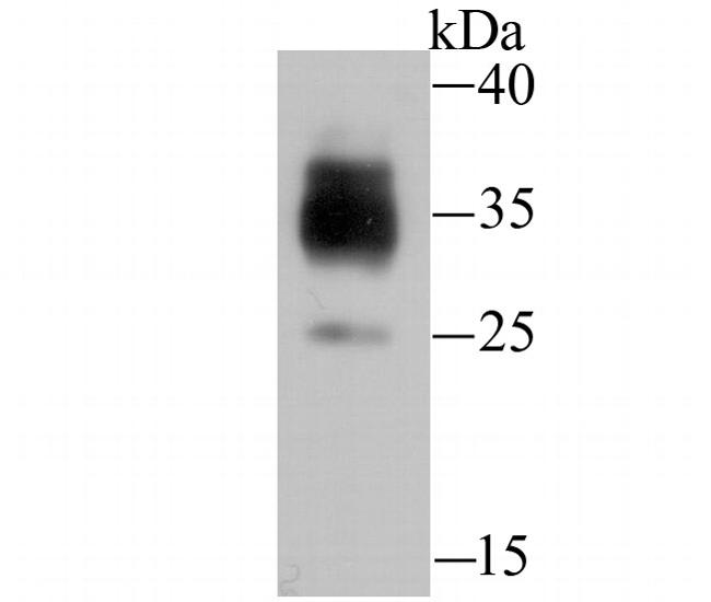 LOX-1 Antibody in Western Blot (WB)