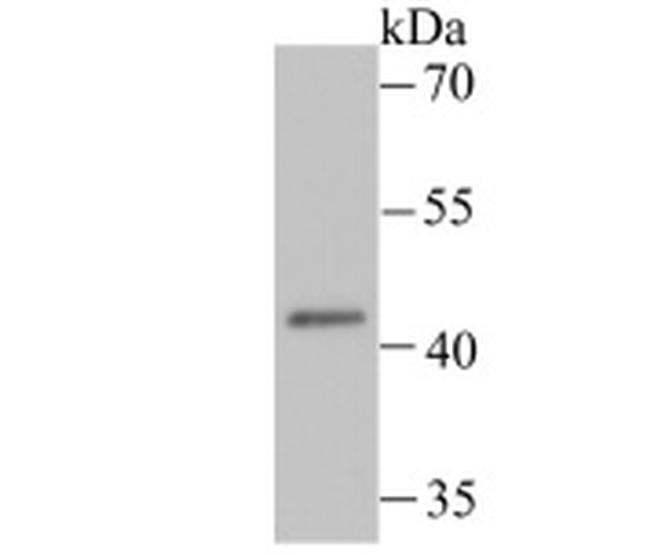 LOX-1 Antibody in Western Blot (WB)