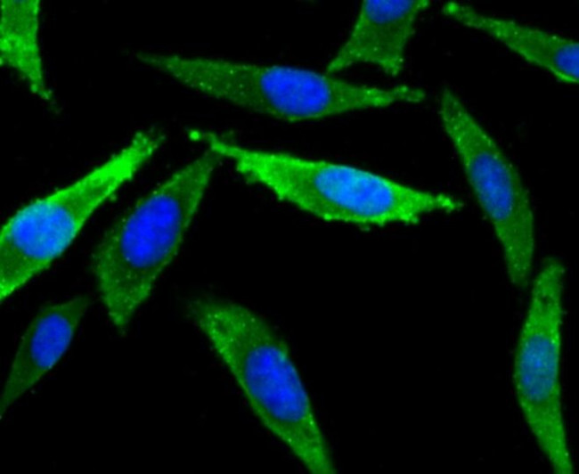 SCN9A Antibody in Immunocytochemistry (ICC/IF)