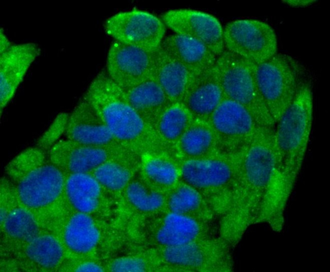 SCN9A Antibody in Immunocytochemistry (ICC/IF)