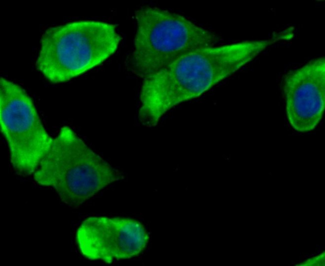 SCN9A Antibody in Immunocytochemistry (ICC/IF)