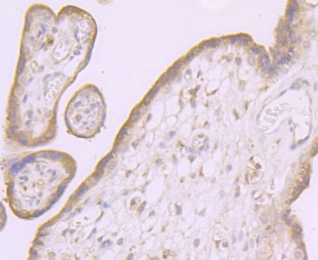 SCN9A Antibody in Immunohistochemistry (Paraffin) (IHC (P))