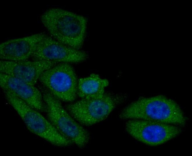 AMACR Antibody in Immunocytochemistry (ICC/IF)