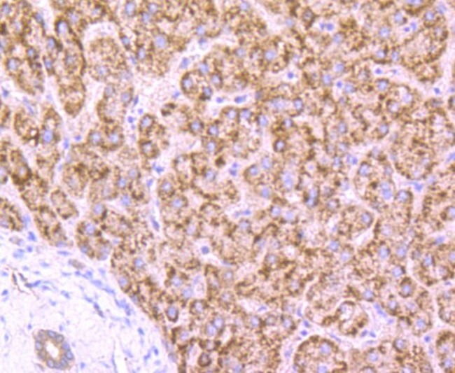 AMACR Antibody in Immunohistochemistry (Paraffin) (IHC (P))