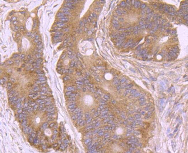 AMACR Antibody in Immunohistochemistry (Paraffin) (IHC (P))