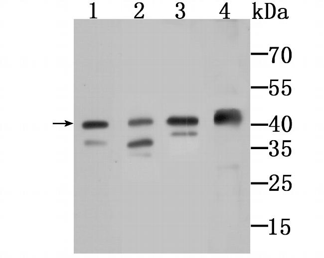 AMACR Antibody in Western Blot (WB)