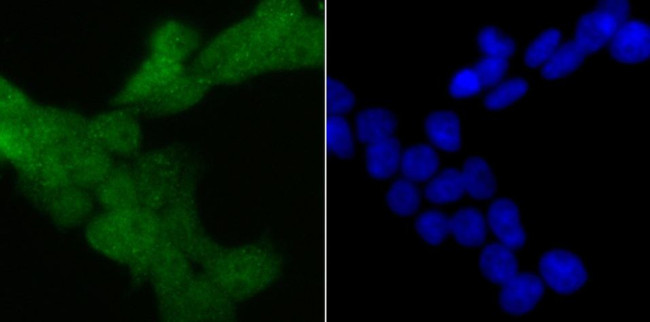 4EBP1 Antibody in Immunocytochemistry (ICC/IF)