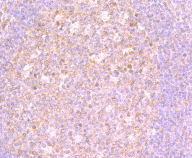 4EBP1 Antibody in Immunohistochemistry (Paraffin) (IHC (P))