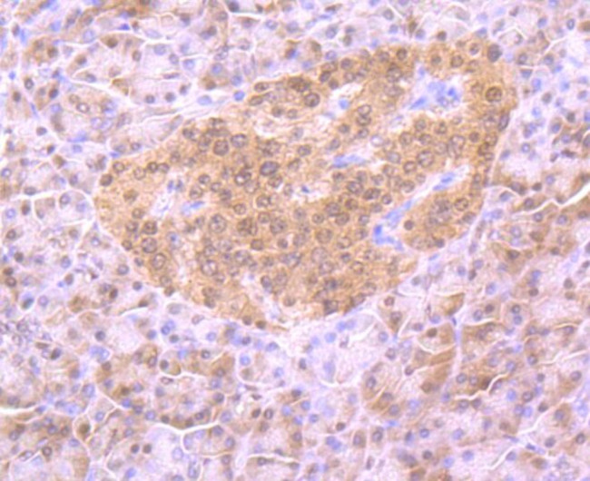 4EBP1 Antibody in Immunohistochemistry (Paraffin) (IHC (P))