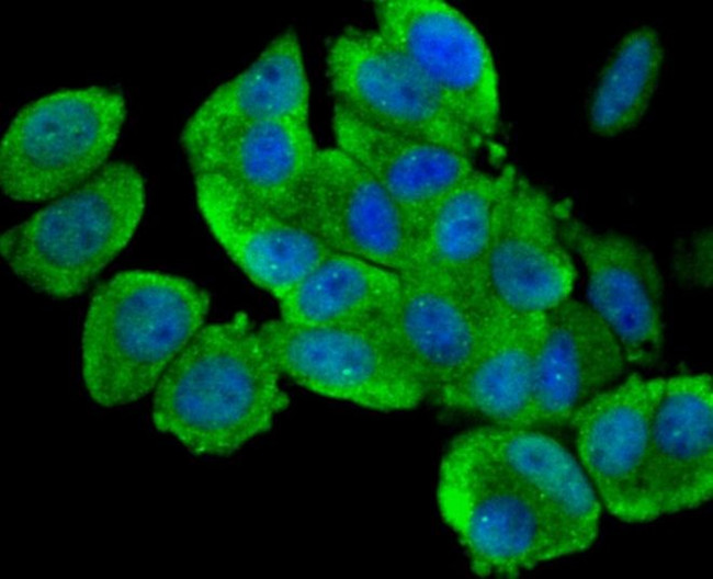 ULK1 Antibody in Immunocytochemistry (ICC/IF)