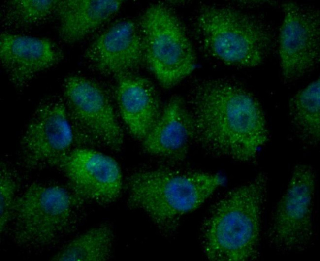 ULK1 Antibody in Immunocytochemistry (ICC/IF)