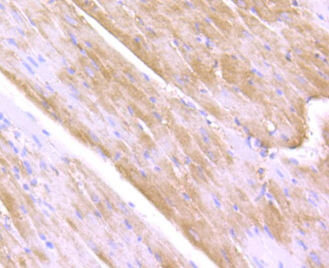 ULK1 Antibody in Immunohistochemistry (Paraffin) (IHC (P))