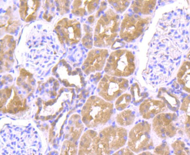 ULK1 Antibody in Immunohistochemistry (Paraffin) (IHC (P))