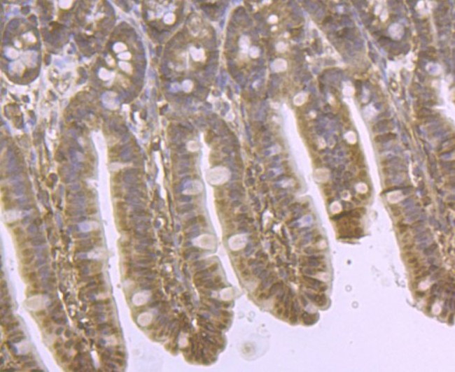 DDIT4 Antibody in Immunohistochemistry (Paraffin) (IHC (P))