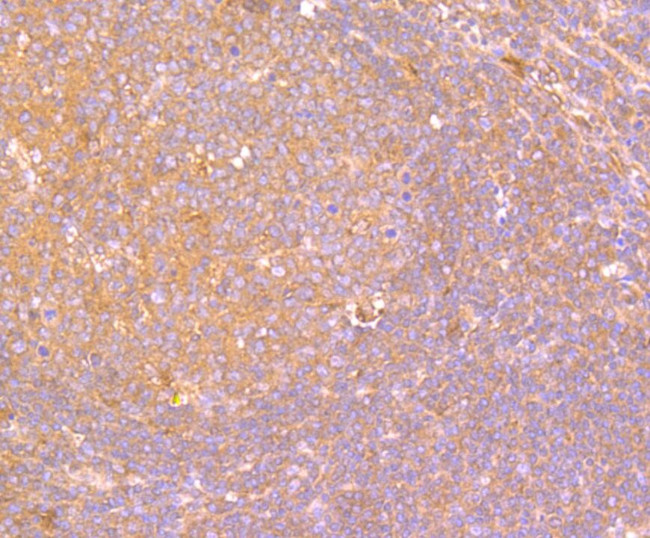 IL-19 Antibody in Immunohistochemistry (Paraffin) (IHC (P))