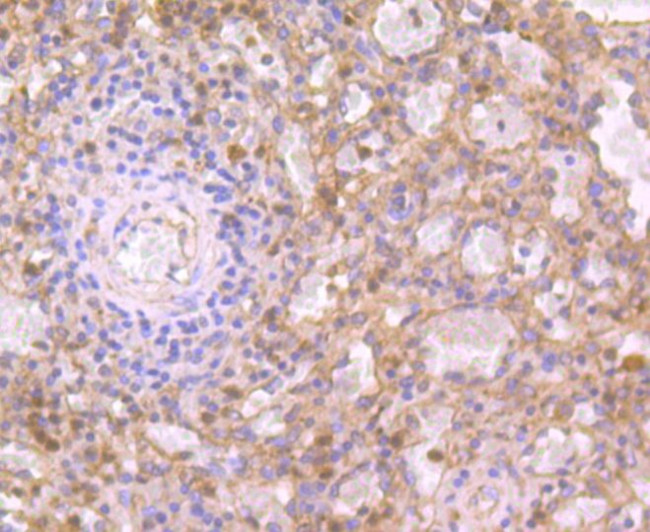 IL-19 Antibody in Immunohistochemistry (Paraffin) (IHC (P))