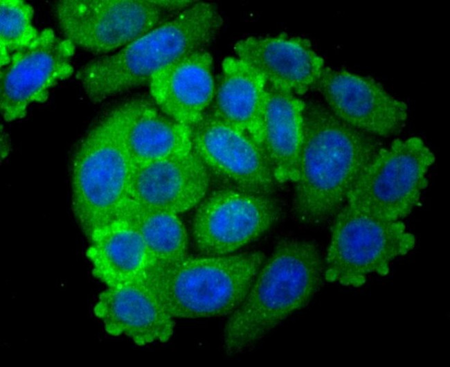 PSMA Antibody in Immunocytochemistry (ICC/IF)