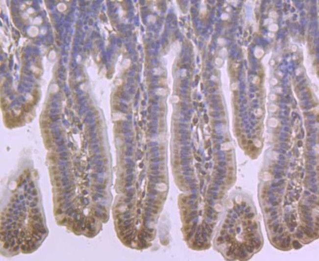 TSPO Antibody in Immunohistochemistry (Paraffin) (IHC (P))