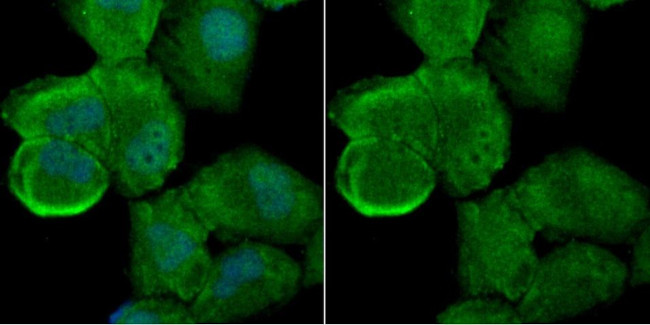 ATG7 Antibody in Immunocytochemistry (ICC/IF)