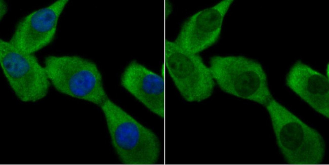 ATG7 Antibody in Immunocytochemistry (ICC/IF)