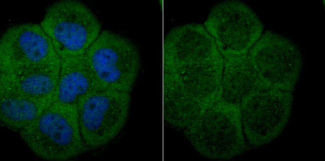 ATG7 Antibody in Immunocytochemistry (ICC/IF)