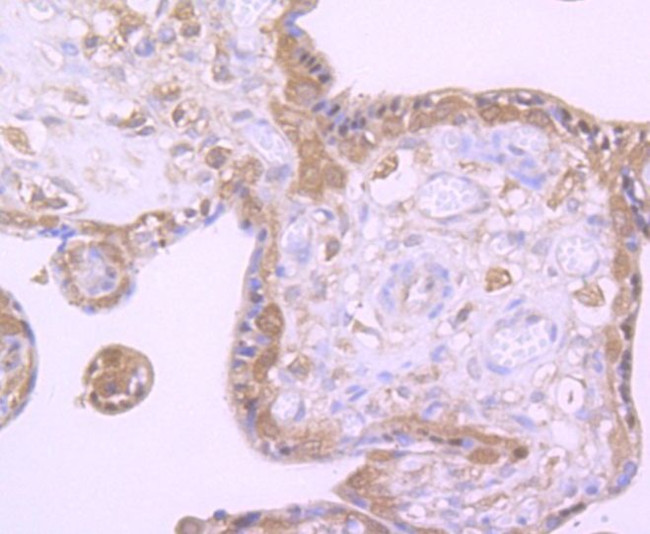 ATG7 Antibody in Immunohistochemistry (Paraffin) (IHC (P))