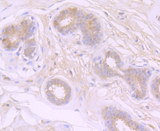 ATG7 Antibody in Immunohistochemistry (Paraffin) (IHC (P))