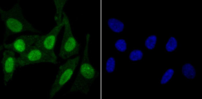 KDM5B Antibody in Immunocytochemistry (ICC/IF)