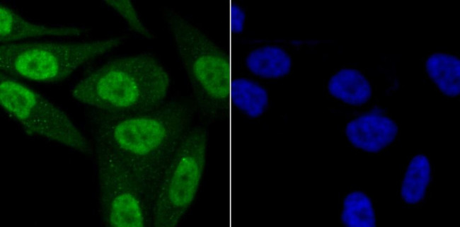 KDM5B Antibody in Immunocytochemistry (ICC/IF)