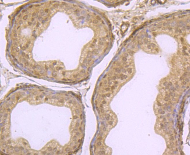 KDM5B Antibody in Immunohistochemistry (Paraffin) (IHC (P))