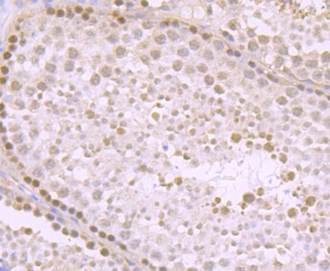 KDM5B Antibody in Immunohistochemistry (Paraffin) (IHC (P))