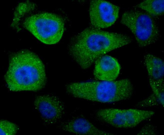 USP21 Antibody in Immunocytochemistry (ICC/IF)