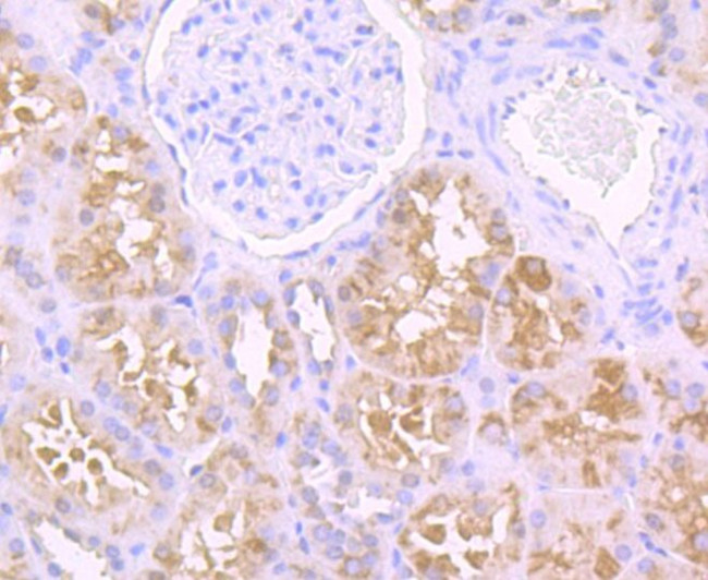 USP21 Antibody in Immunohistochemistry (Paraffin) (IHC (P))