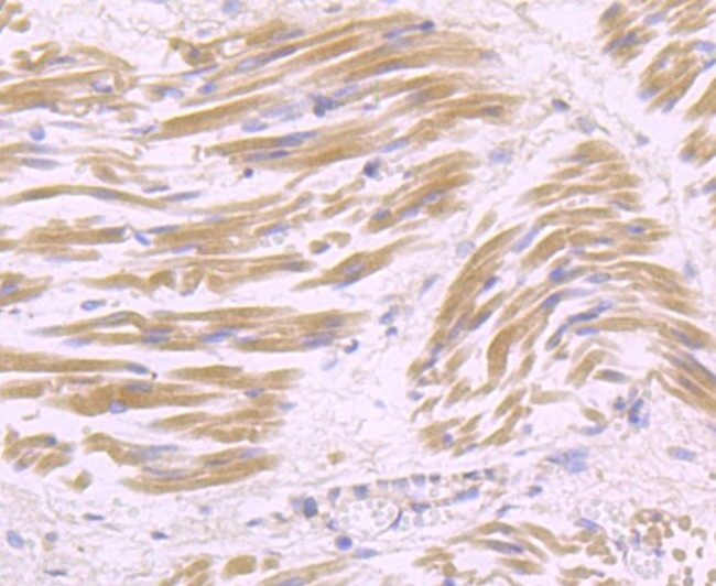 USP21 Antibody in Immunohistochemistry (Paraffin) (IHC (P))