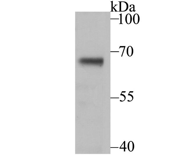 USP21 Antibody in Western Blot (WB)