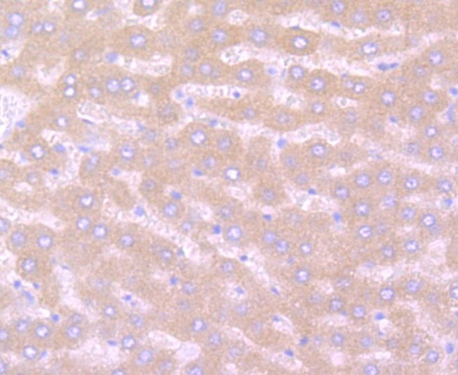 Noggin Antibody in Immunohistochemistry (Paraffin) (IHC (P))