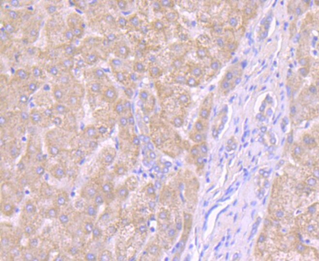 Noggin Antibody in Immunohistochemistry (Paraffin) (IHC (P))