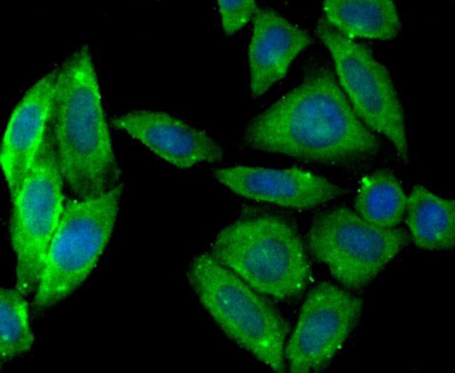 PTP1B Antibody in Immunocytochemistry (ICC/IF)