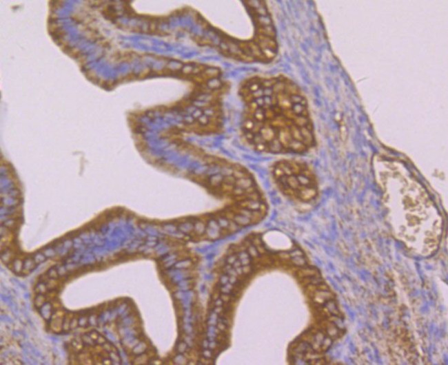 PTP1B Antibody in Immunohistochemistry (Paraffin) (IHC (P))