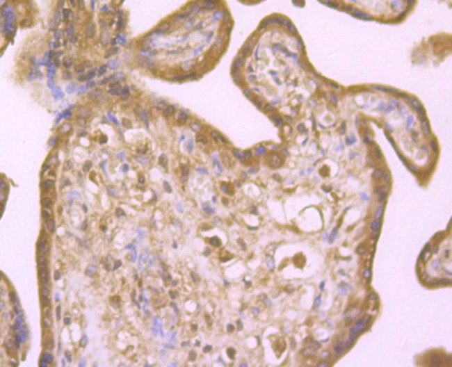 PTP1B Antibody in Immunohistochemistry (Paraffin) (IHC (P))